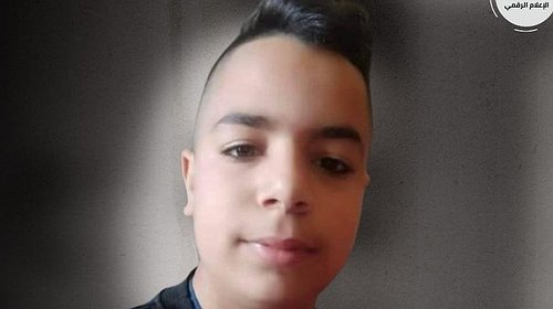 استشهاد طفل متأثر بجراحه برصاص الاحتلال في جنين